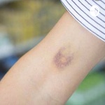 Abuse in quarantine