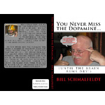 You Never Miss the Dopamine (until the brain runs dry)