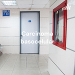 Carcinoma basocelular - Bárbara, Bianca, Eder , Nicole, Rafael, Walquíria e Yana