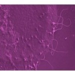 Seminograma y estudios avanzados del semen