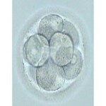 La Fecundación in Vitro explicada con sencillez